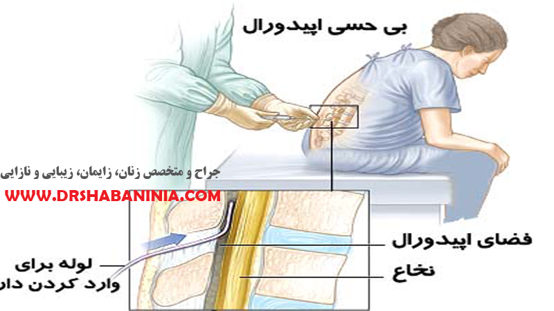 بهترین پزشک زنان اصفهان